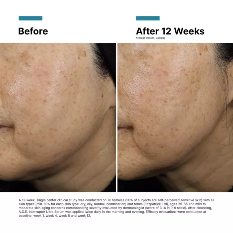 Антивікова сироватка для підтягування шкіри SkinCeuticals A.G.E. Interrupter Advanced Serum 30 мл2